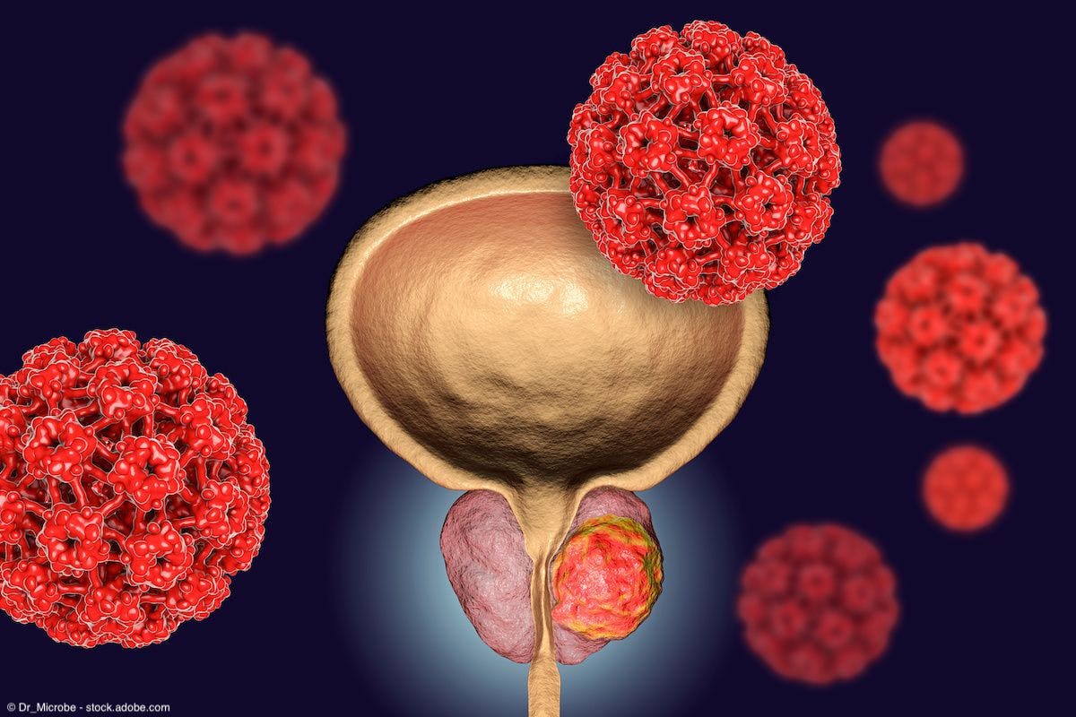 225Ac-PSMA-J591 active in mCRPC with difficult-to-treat metastatic sites