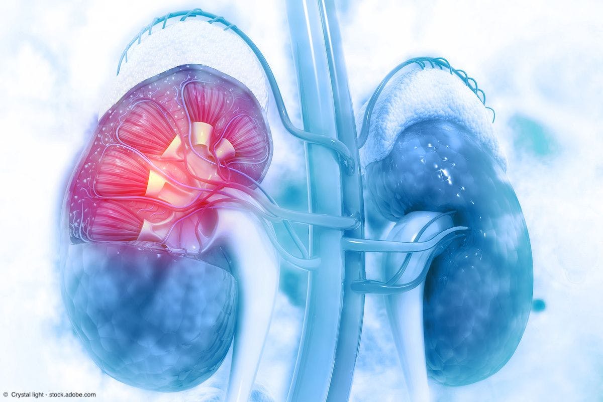 FDA expert reviews data supporting belzutifan approval for VHL-associated kidney cancer